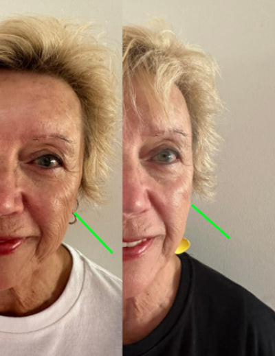 TL17+ Regenerative Skin Cream