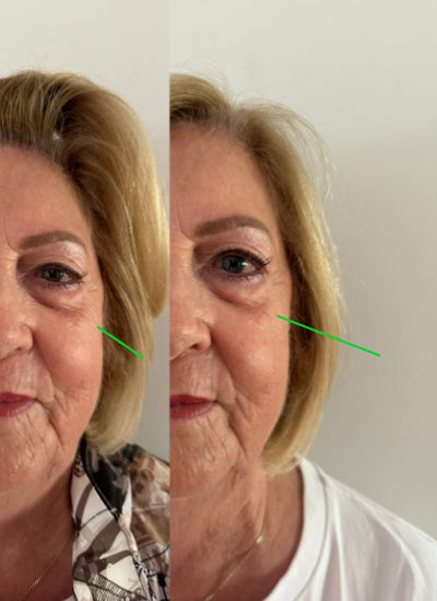TL17+ Regenerative Skin Cream