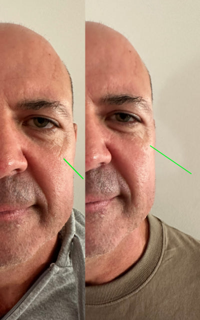 TL17+ Regenerative Skin Cream